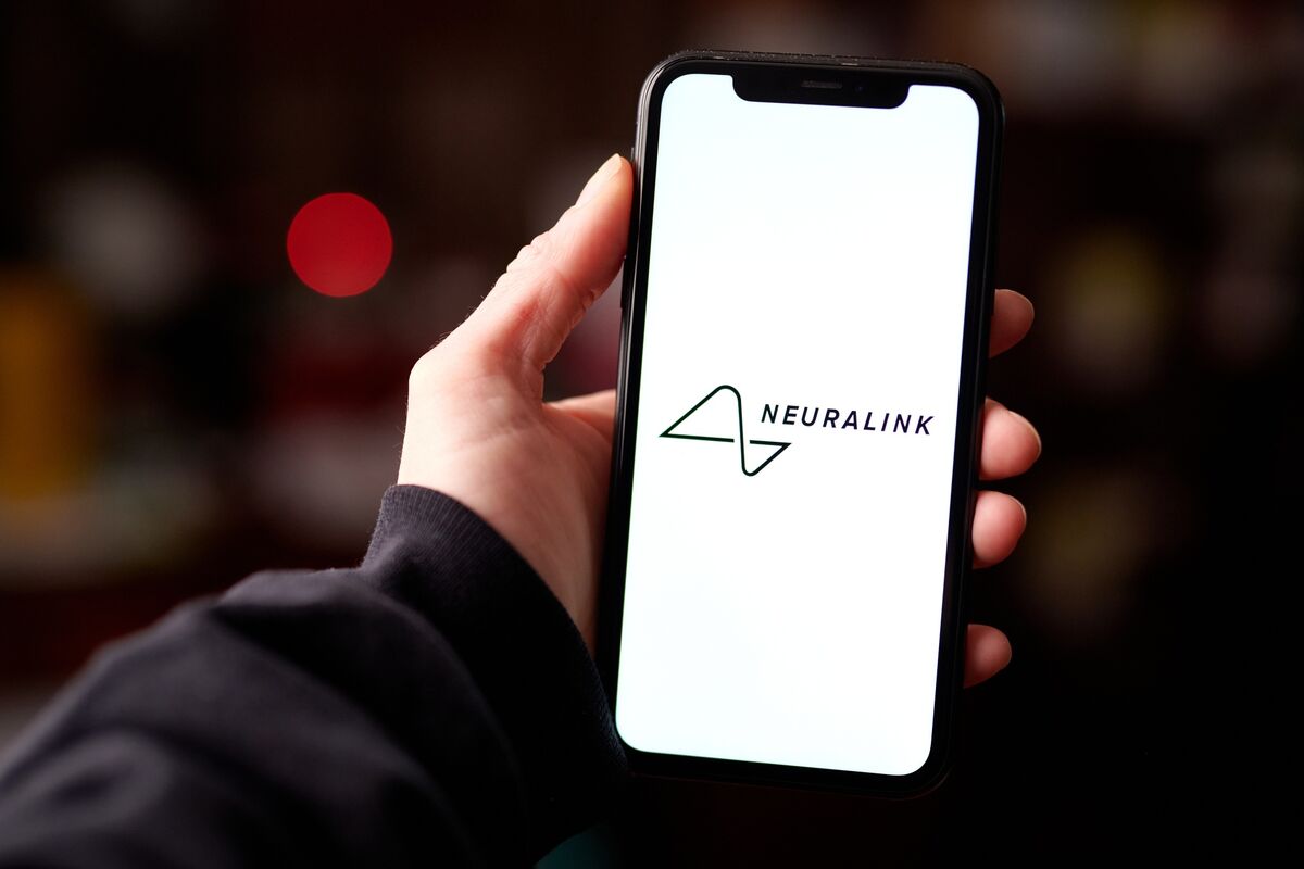 theomitsa's tweet card. Elon Musk’s brain implant company Neuralink Corp. is collaborating with researchers in California and Spain on a clinical trial to study visual prosthetics.