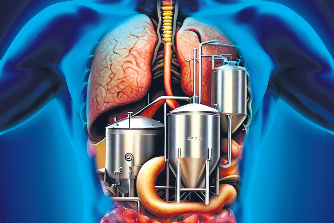 NovogeneAMEA's tweet card. Auto-brewery syndrome is a rare condition where bacteria and fungi in the gut turn carbs in food into alcohol. Read more at straitstimes.com. Read more at straitstimes.com.