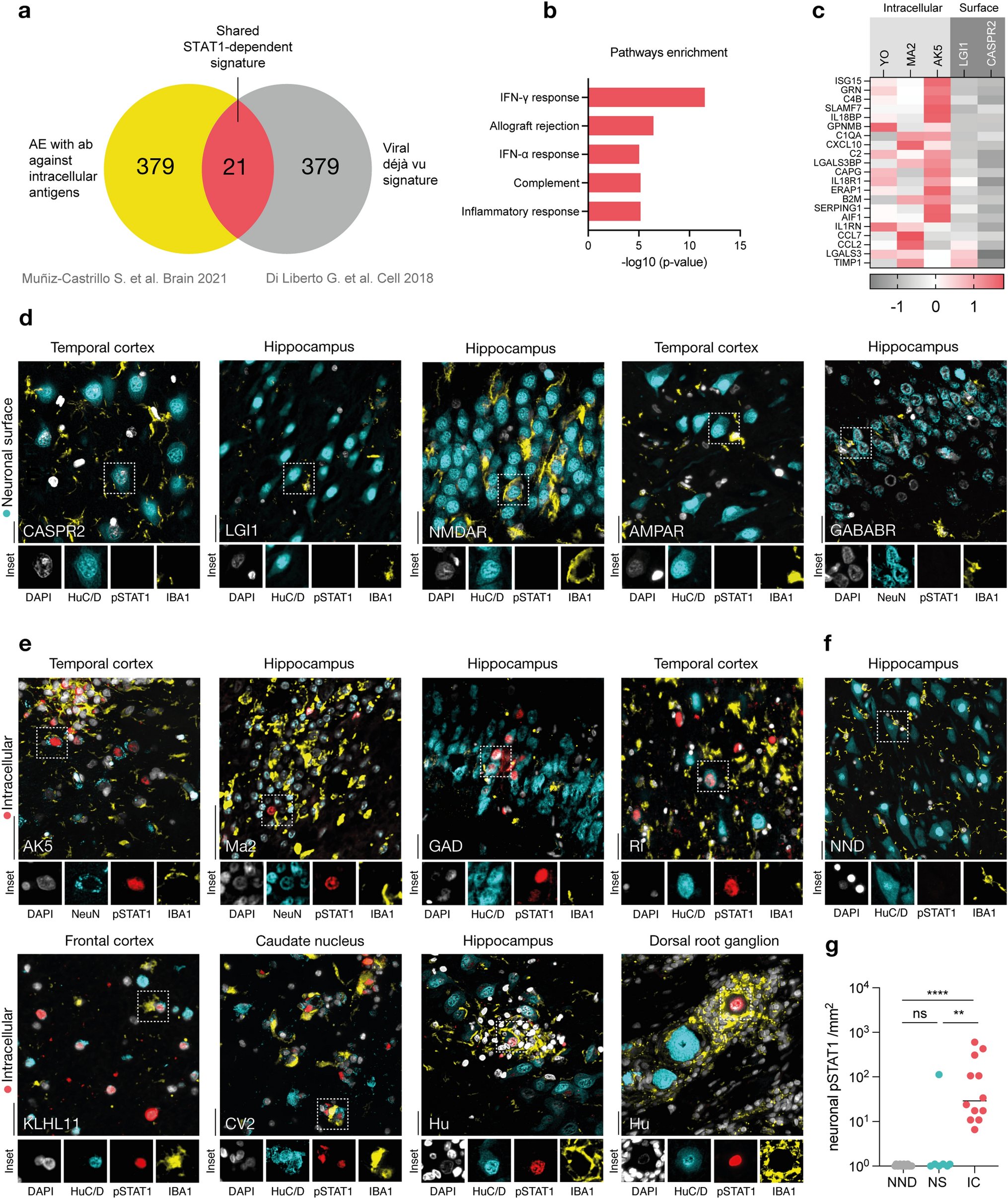 GCIR_Unige's tweet card. Acta Neuropathologica - Autoimmune encephalitis (AE) is an inflammatory syndrome of the central nervous system (CNS) triggered by aberrant immune responses against neuronal intracellular (IC-AE) or...