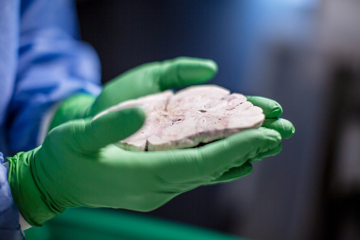 AllenInstitute's tweet card. A collaborative effort between UW and the Allen Institute is creating a first-of-its-kind brain atlas, paving the way for breakthroughs in brain health.