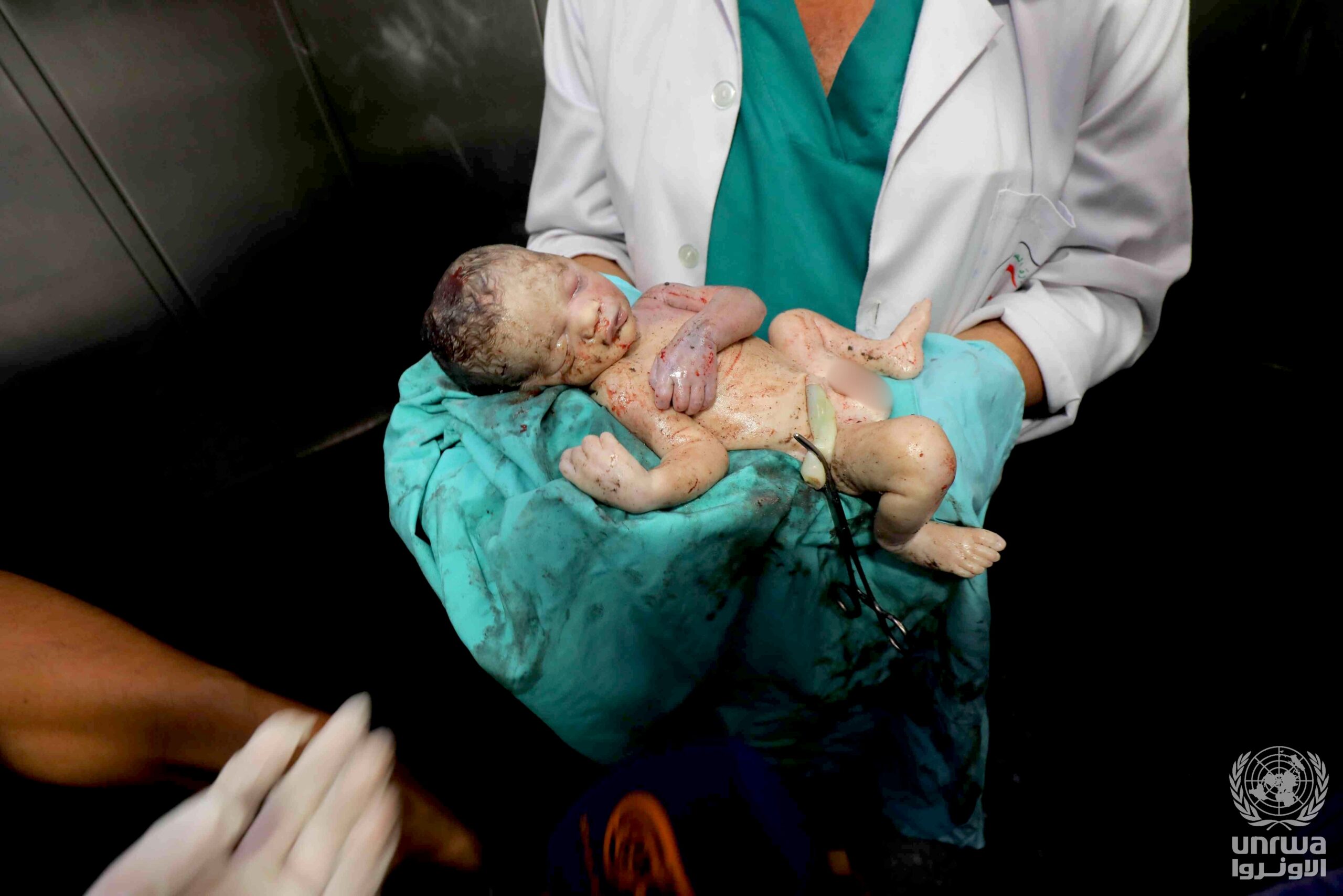 LewStuhl's tweet card. Those tiny skeletal bodies you’re seeing on social media are the fruits of the empire. So are the shredded, eviscerated, decapitated children in Gaza since 2023.  This can never be unknown. By...