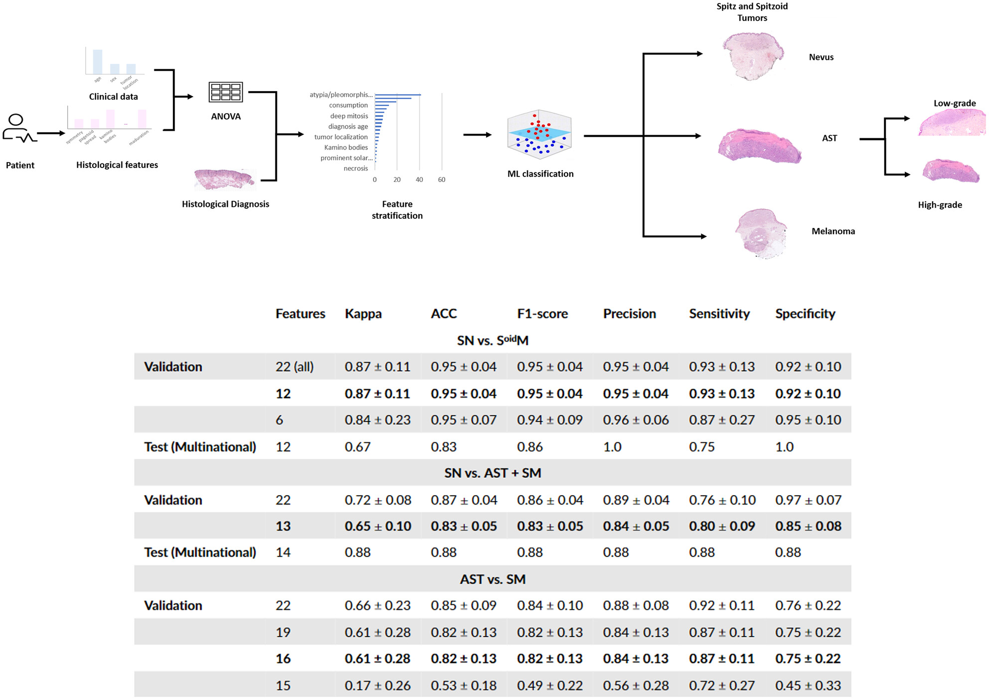 andredavmos's tweet card. Our machine learning models improve histopathological diagnostic decision-making, ranking the importance of the histological variables for the classification of Spitz and spitzoid tumours.