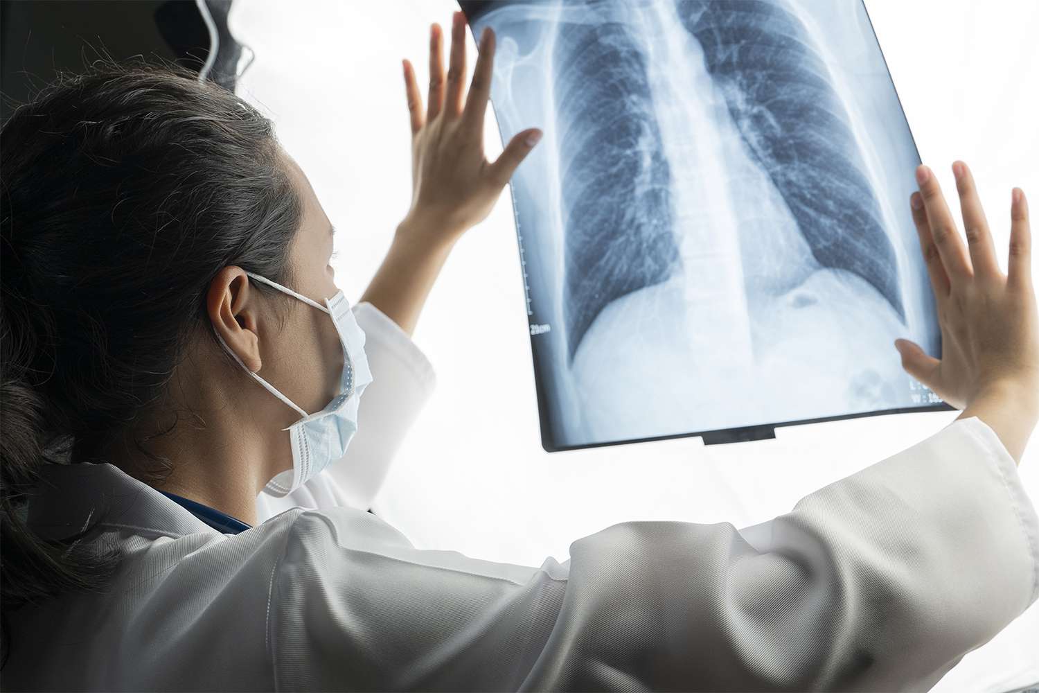 LCAM_org's tweet card. A new study found that the proportion of people being diagnosed with lung cancer who have never smoked is increasing, and air pollution may be a leading cause.