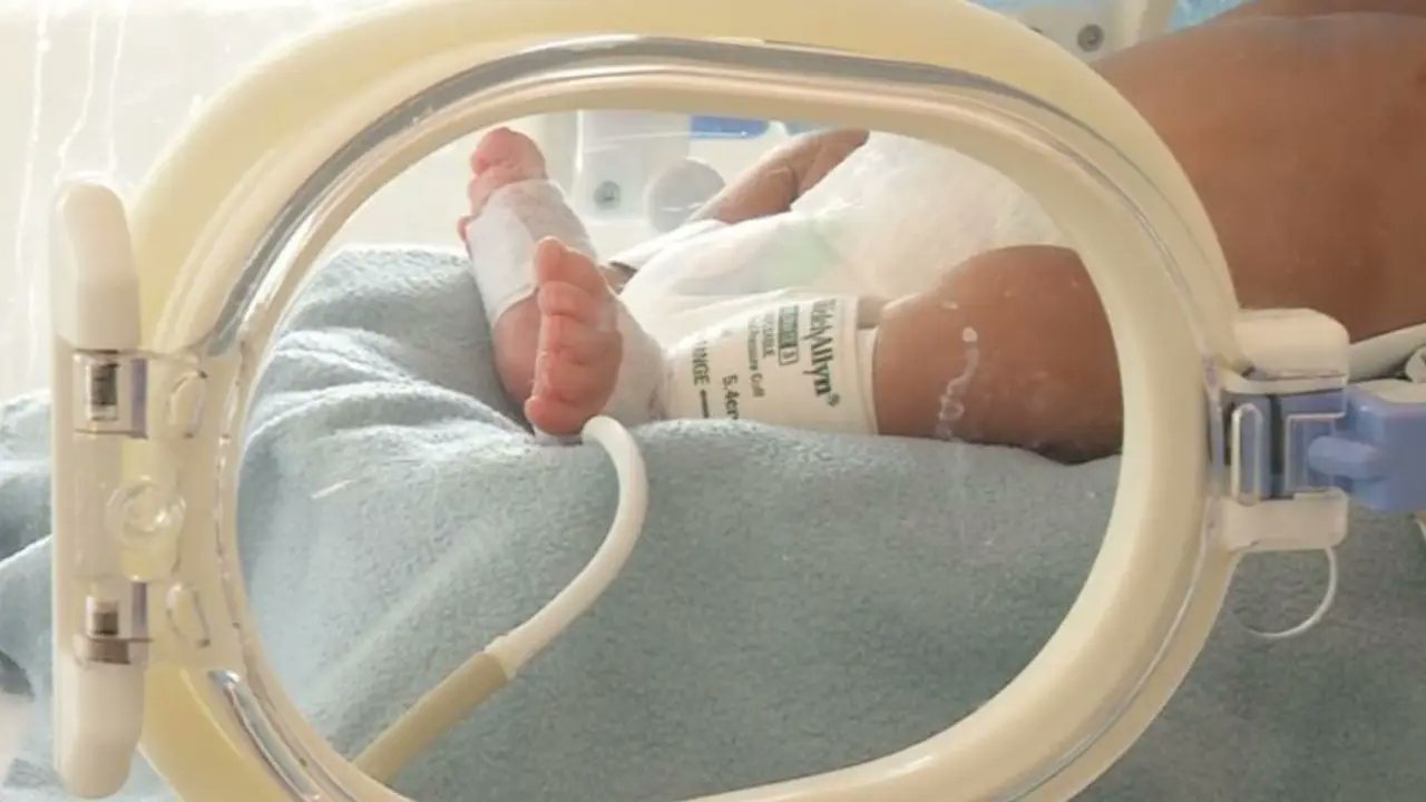 NoticiasCaracol's tweet card. Su nombre es Nash y se hizo muy conocido en redes sociales por ser considerado el bebé más prematuro del mundo. Nació en los Estados Unidos y esta es su conmovedora historia.