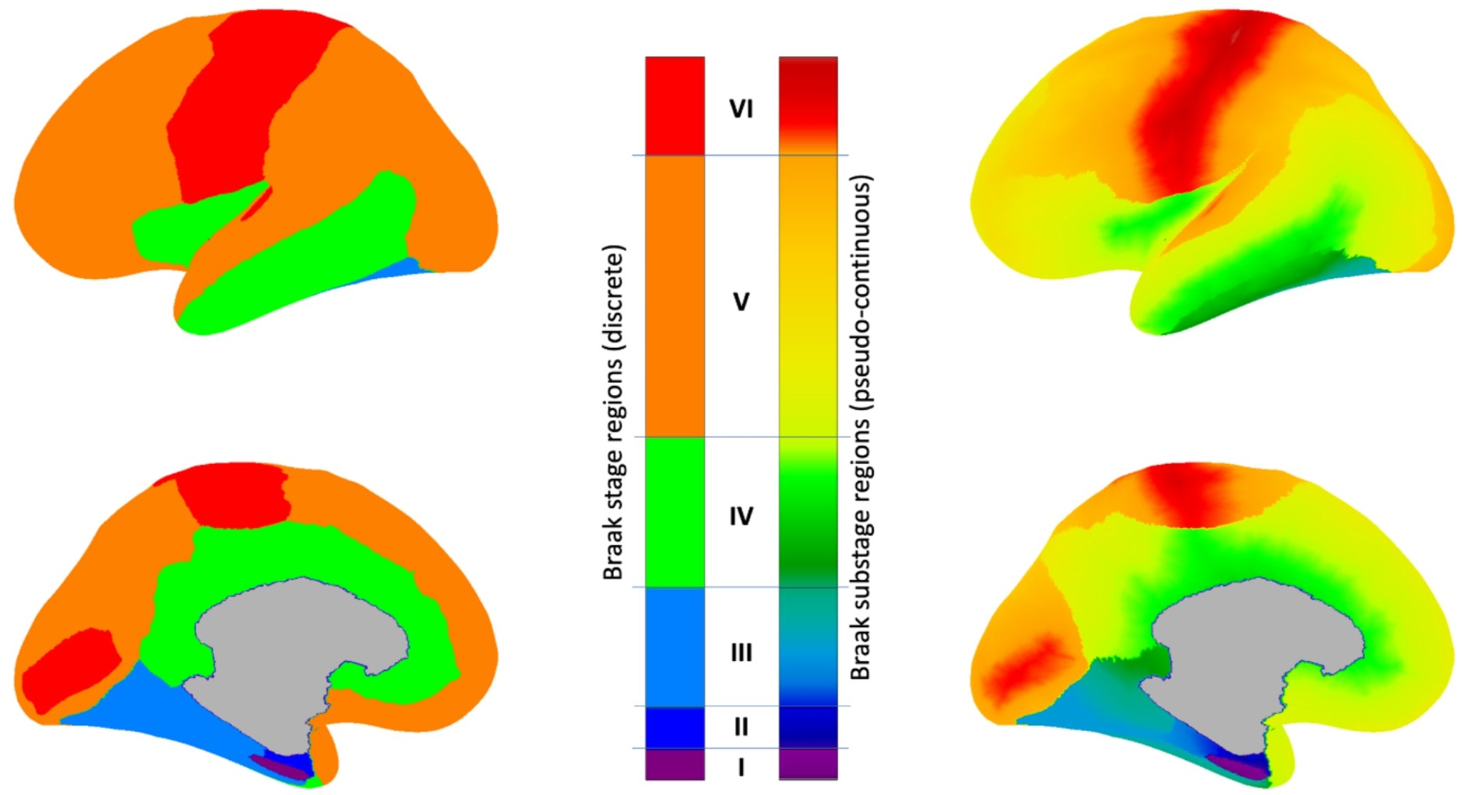 BezginGleb's tweet card. European Journal of Nuclear Medicine and Molecular Imaging - Inter-individual variability in tau topography challenges the propagation hypothesis of tau aggregates. To address this gap, we propose...