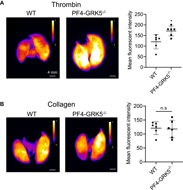 ADJomics's tweet card. Our prior genome-wide association study of thrombin-induced platelet aggregation identified a G protein–coupled receptor kinase 5 (GRK5) noncoding variant (rs10886430-G) that is strongly associated...