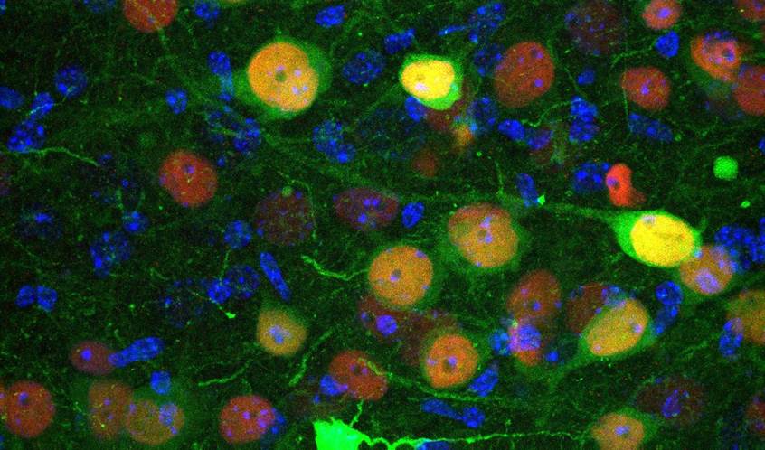 manuelmuro5's tweet card. Restaurar el equilibrio en esas neuronas en un modelo animal revierte conductas similares a la ansiedad, depresión y autismo.