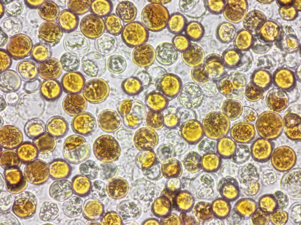 AlgatechTrebon's tweet card. ALGATECH Centre - Inst. Microbiol. Czech Acad. Sci. (IMIC) has successfully completed the commercialization process of its unique #microalgae strain #Parachlorella. The bred strain is yellow, so it...