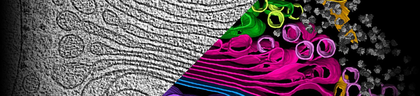 bcarra2's tweet card. Learn about the winners of our competition to advance the understanding of cell biology through machine learning algorithms to annotate particles in 3D images of cells captured by cryoET.