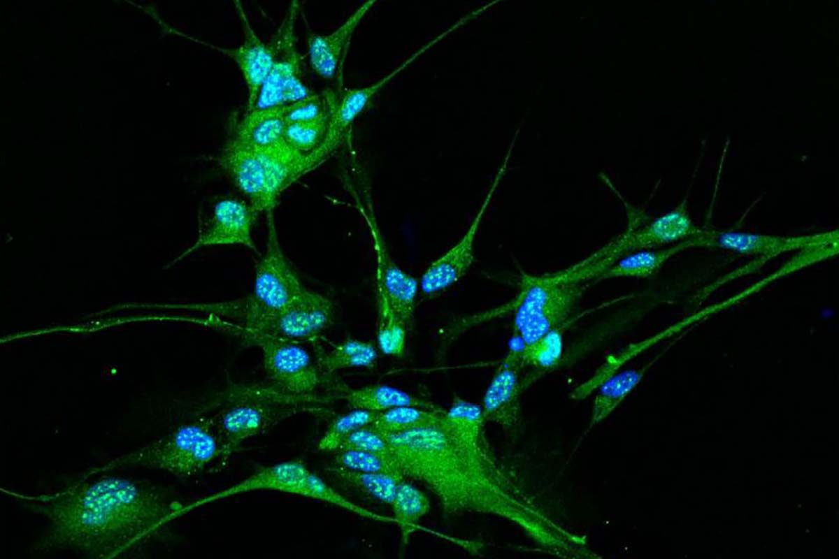 BiotechMN's tweet card. La visualización de cómo se multiplican las células malignas en el glioblastoma ha sido acogida con esperanza en la comunidad científica.