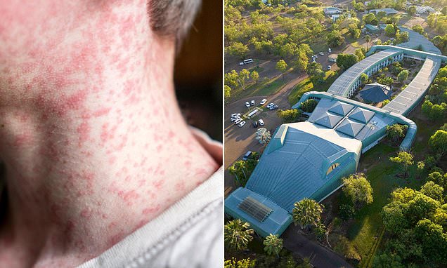 DailyMailAU's tweet card. A major health alert has been issued in Northern Territory after an infected man visited popular tourist hotspots.