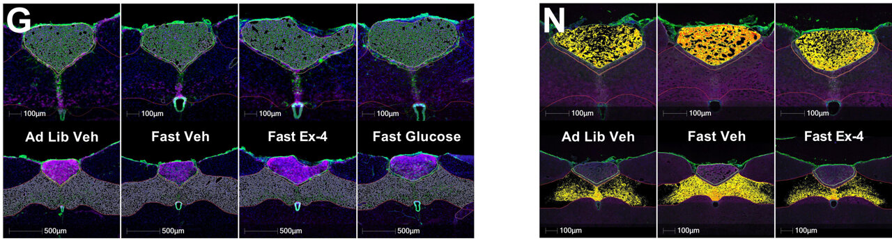 kcnickerson's tweet card. University of Pennsylvania and Syracuse University scientists have discovered that a hindbrain-derived peptide, octadecaneuropeptide (ODN), can suppress appetite and improve glucose regulation...