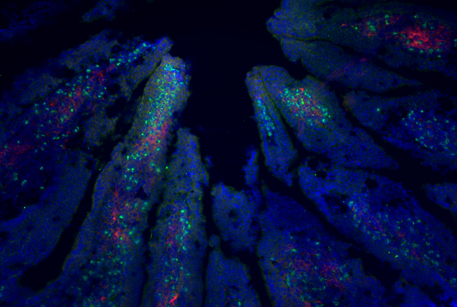 IlievLab's tweet card. Unlocking Gut Health Via harnessing the power of fungi, microbiota and immunity Our laboratory studies the mechanisms by which fungal and bacterial symbionts, interact with their host to influence...