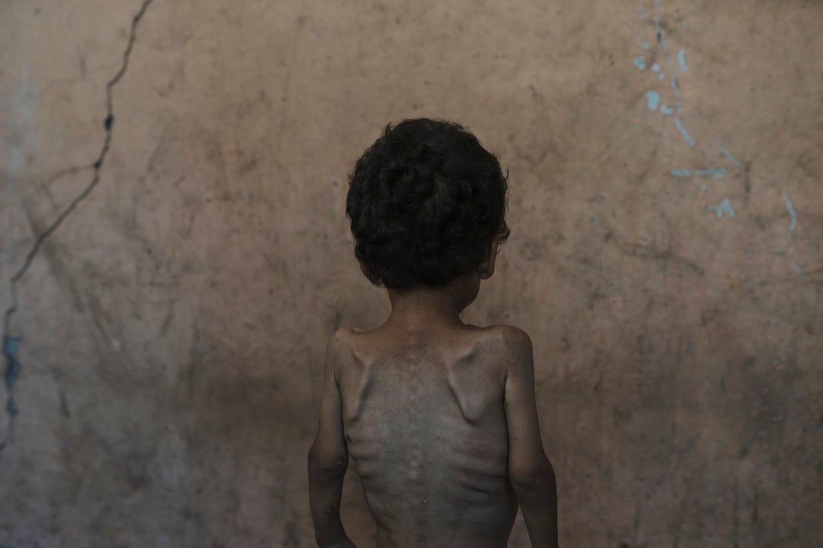 TatiIniguez's tweet card. El bloqueo israelí empuja a más de dos millones de personas a sobrevivir sin apenas alimentos. Más de 100 organizaciones denuncian una catástrofe humanitaria provocada deliberadamente