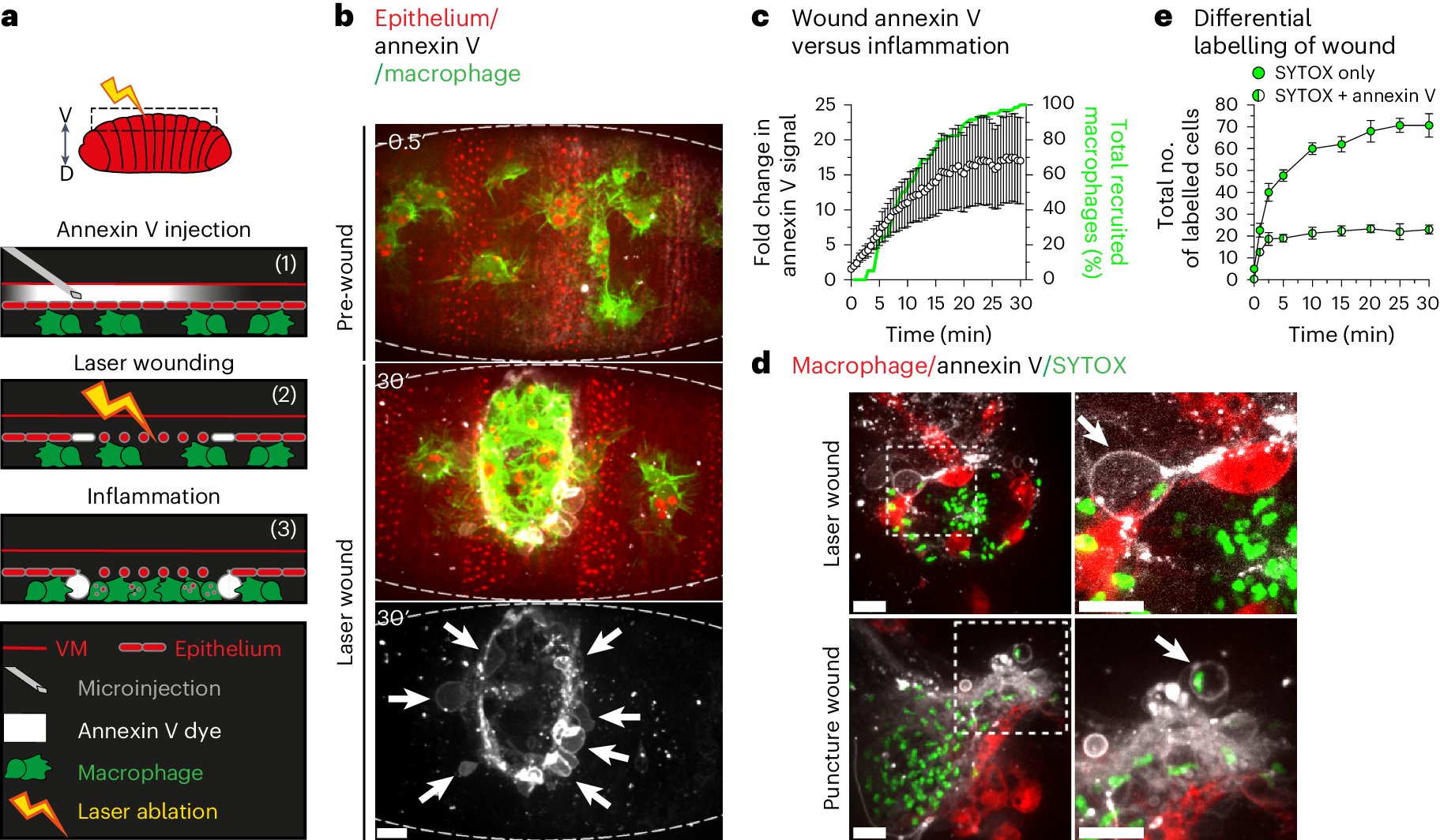 DavidsnDeathLab's tweet card. Nature Cell Biology - Davidson et al. visualize ferroptosis-like cell death using three-colour live imaging in vivo and demonstrate its role in triggering macrophage recruitment but delaying...