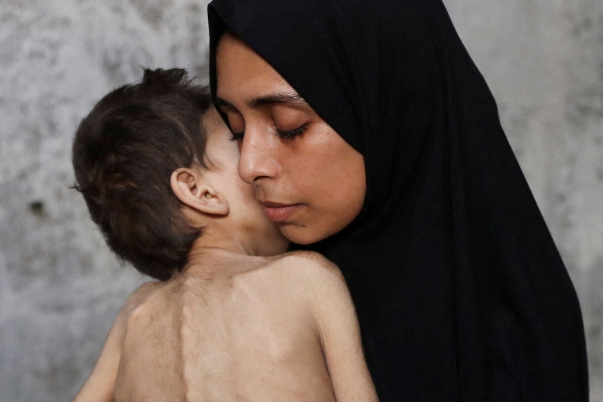 stephenlemons's tweet card. Children suffering under severe food shortages can face lifelong consequences.