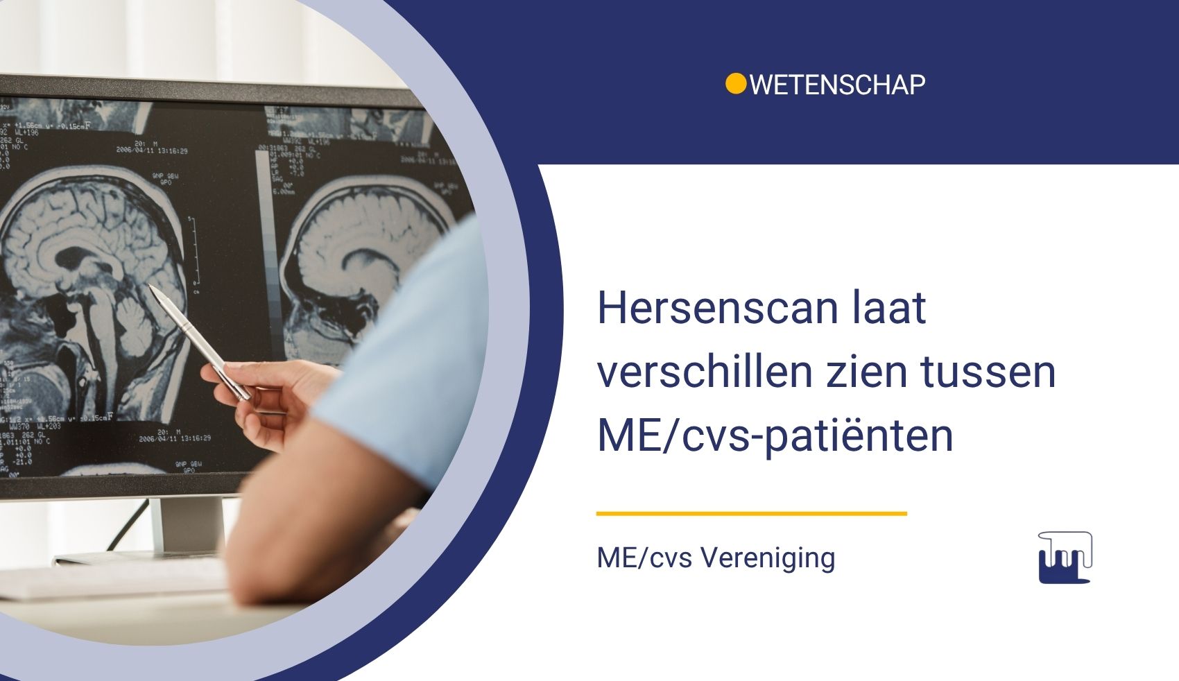 MEcvsVereniging's tweet card. Bij een hersenscan zijn verschillen zichtbaar tussen patiënten met een geleidelijk begin van de ziekte en een post-infectueus begin van de ziekte