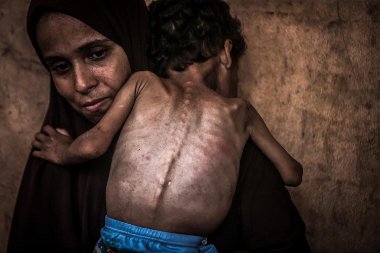 mainulh_'s tweet card. These images are part of a series highlighting the suffering of children in Gaza, where a humanitarian disaster is escalating and civilians are starving.