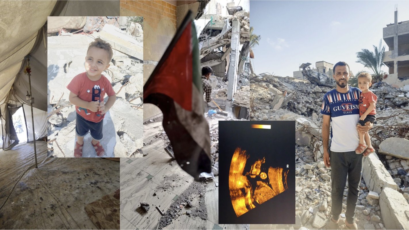 moonw4tching's tweet card. Alaa, a 30-year-old husband and father from northern Gaza, has had his life shattered by war. His home was completely destroyed, forcing his family to flee multiple times, seeking safety in different...