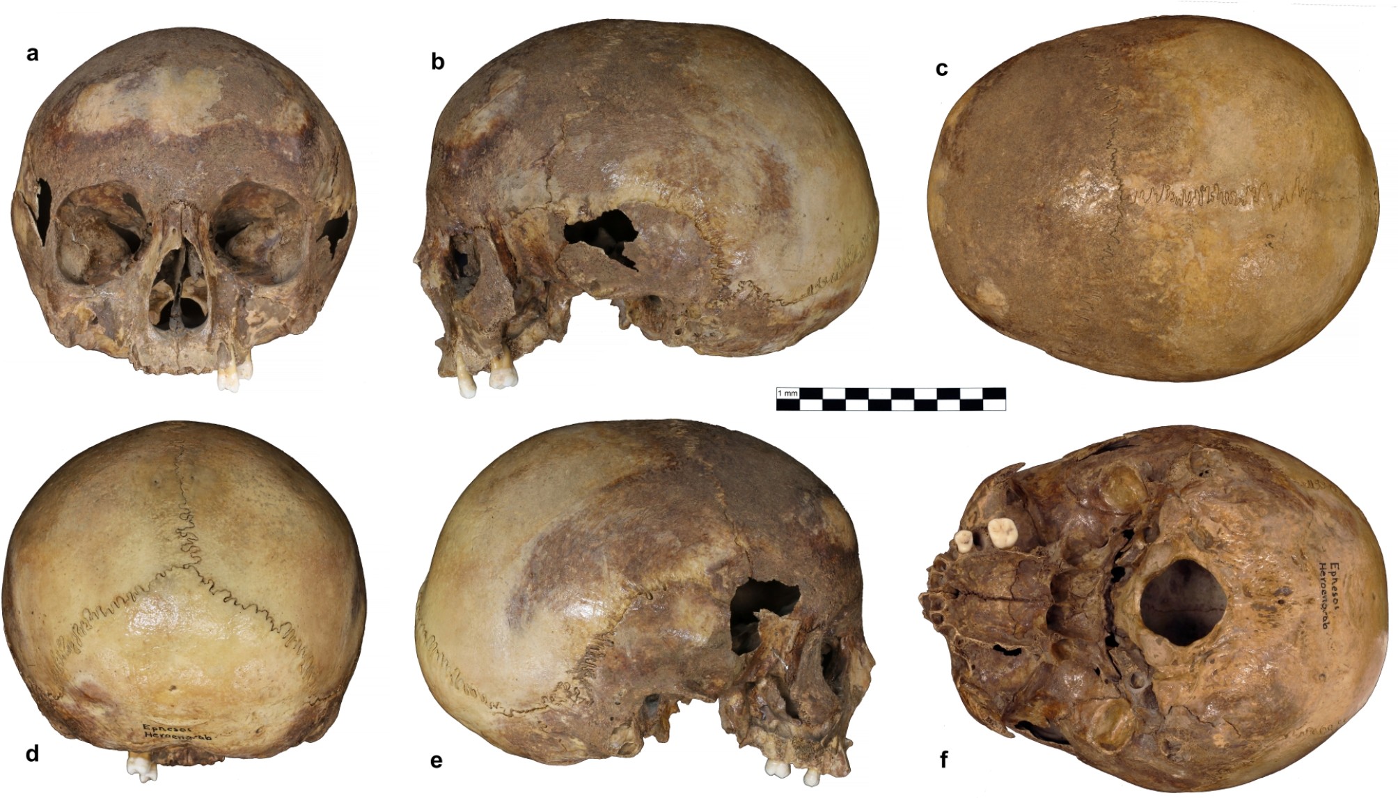 hannes_rathmann's tweet card. Scientific Reports - The cranium from the Octagon in Ephesos