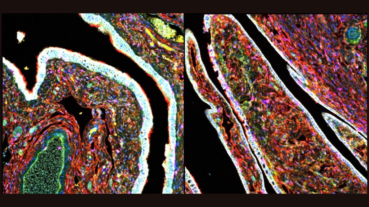 CosmosMagazine's tweet card. A subset of cells in the fallopian tubes drive high-grade serious carcinoma, one of the most aggressive and common forms of ovarian cancer.