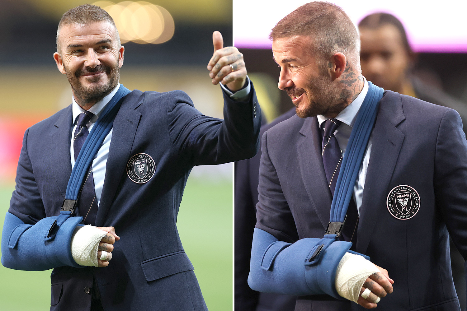 TheFootballPhys's tweet card. DAVID BECKHAM has finally shown the world his arm in a sling – after secret surgery on a 22-year-old injury. The Manchester United legend went into hospital for an operation this week, having…