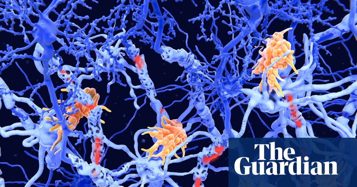 SnyderInstitute's tweet card. Some researchers say a new approach, which suppresses a particular part of the immune system rather than amplifying it, could be available in the next five years