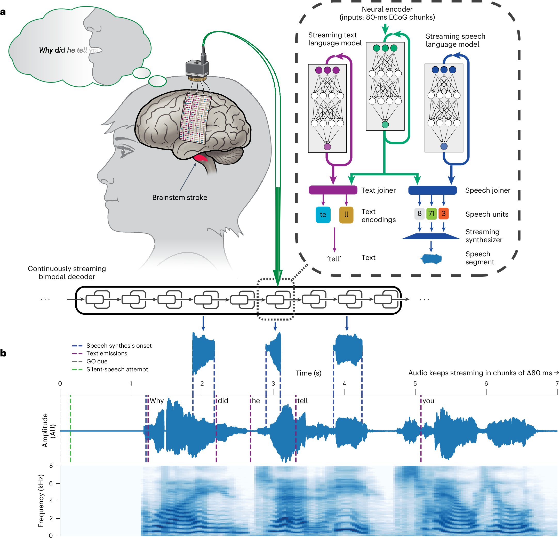 csmfisher's tweet card. Nature Neuroscience - Naturalistic communication is an aim for neuroprostheses. Here the authors present a neuroprosthesis that restores the voice of a paralyzed person simultaneously with their...