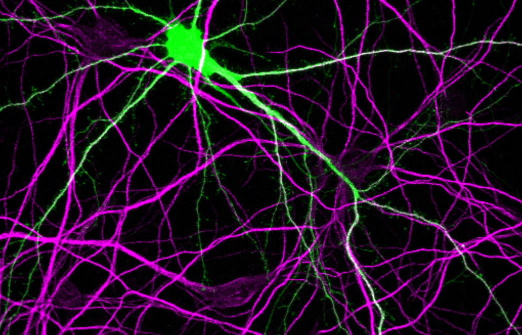 SaarikangasLab's tweet card. Cells constantly surveil and monitor their proteome to ensure proper function. These processes, spanning multiple steps from protein synthesis to folding and degradation, are collectively known as pr…