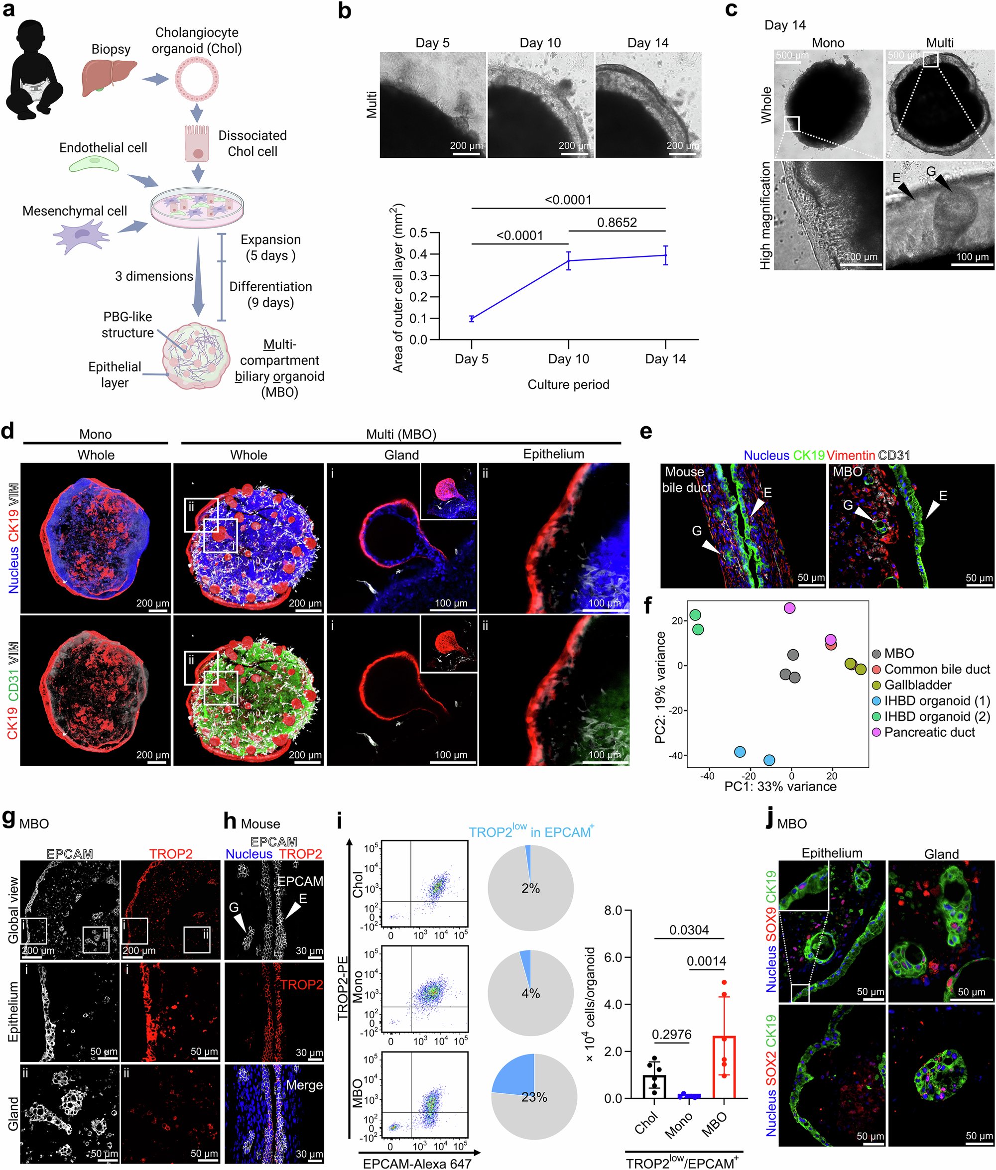 MANunezSanchez's tweet card. Nature Communications - The study reveals that TGF-β–driven epithelial-mesenchymal transition disrupts bile duct development in biliary atresia. Inhibiting this pathway restores...