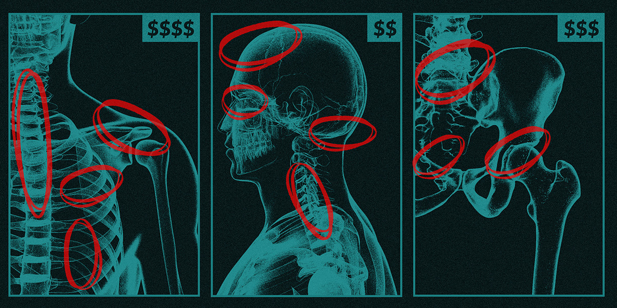 cdweaver's tweet card. An investigation into the secret practices insurers use to pocket billions from Medicare.