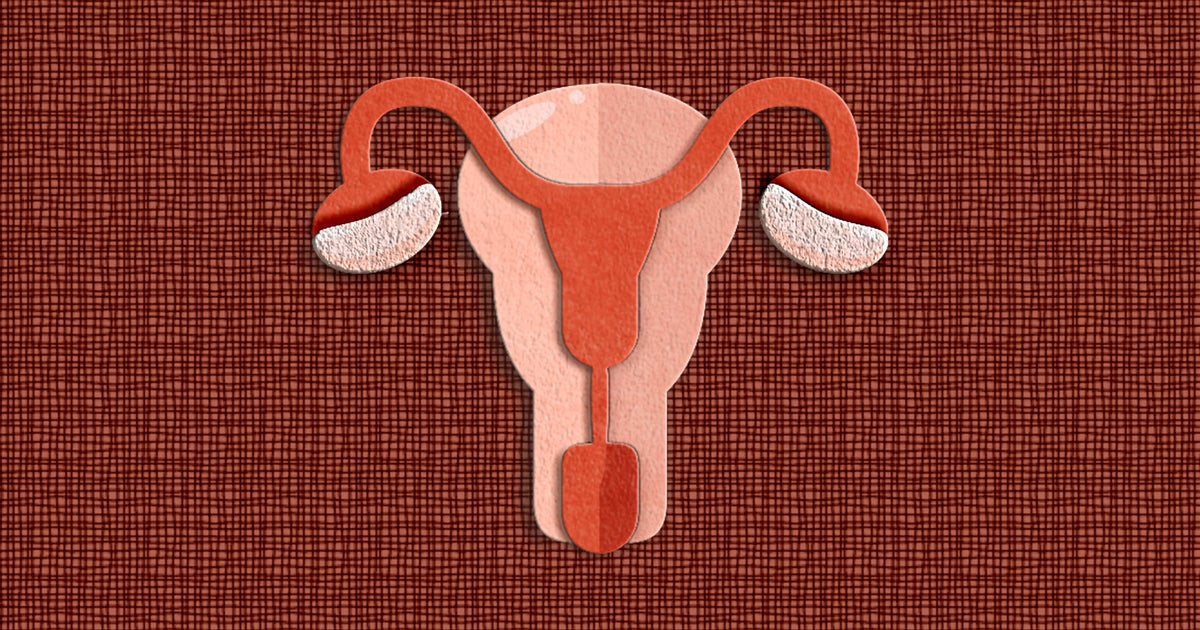 HuffPost's tweet card. Polycystic ovary syndrome is a condition caused by a hormone imbalance and impacts millions of people of reproductive age.