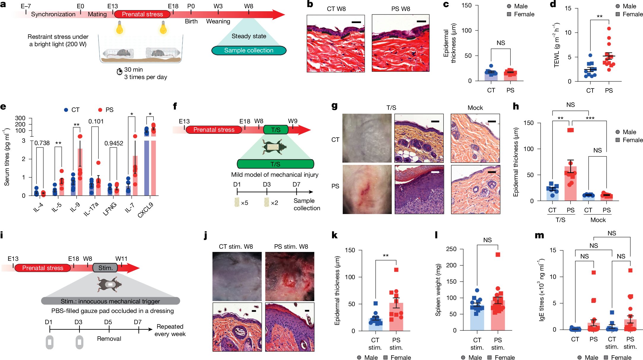 Lo_Zanzi's tweet card. Nature - Prenatal stress triggers molecular dysregulations in fetal neuroimmune circuits, leading to altered mast cell and sensory neuron function, which predisposes offspring to develop eczema in...