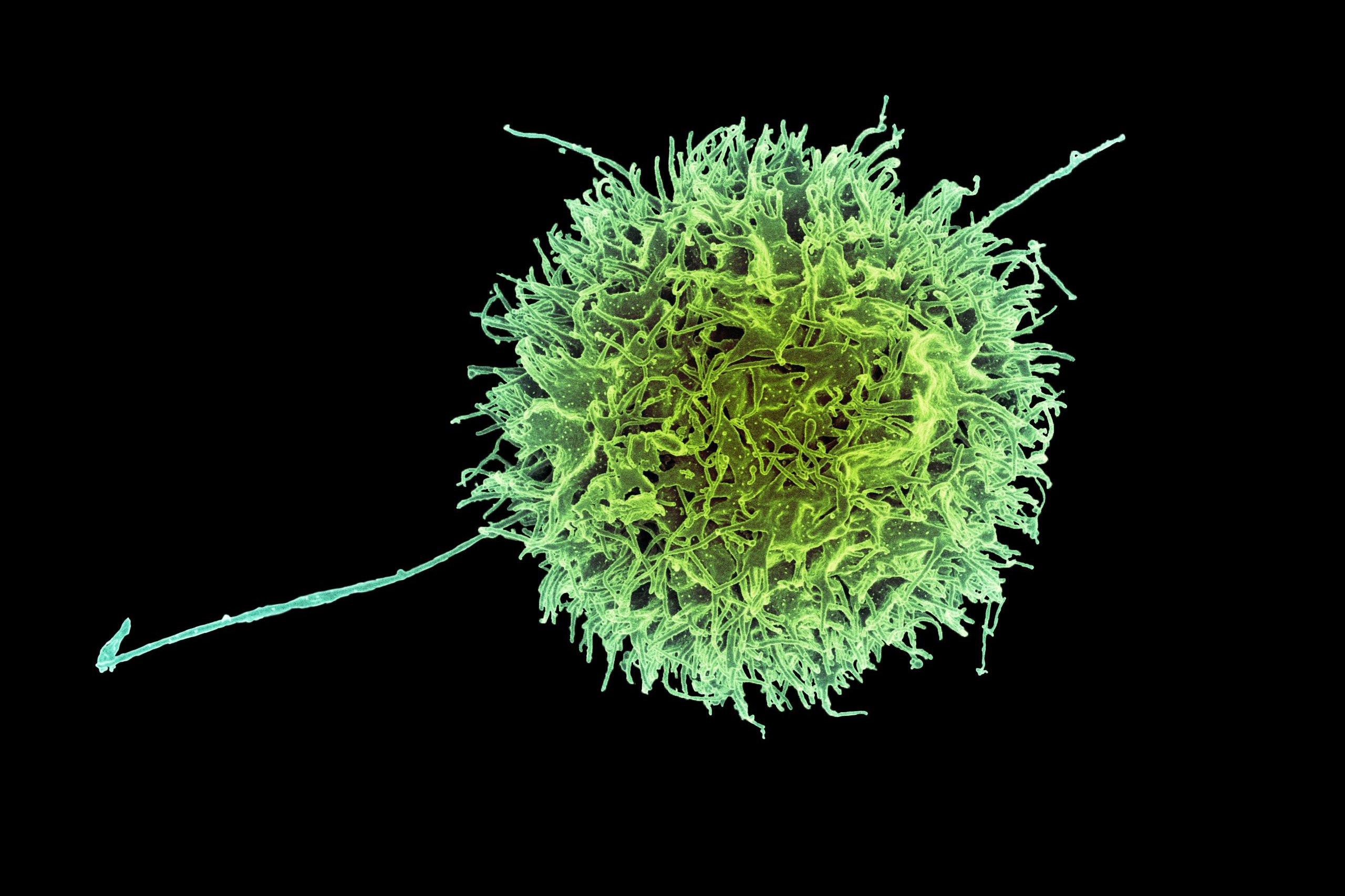 _Georgeobeid's tweet card. MIT and Harvard scientists have created engineered CAR-NK cells that can hide from the immune system and more effectively destroy cancer. The cells are designed to suppress immune-rejection signals...