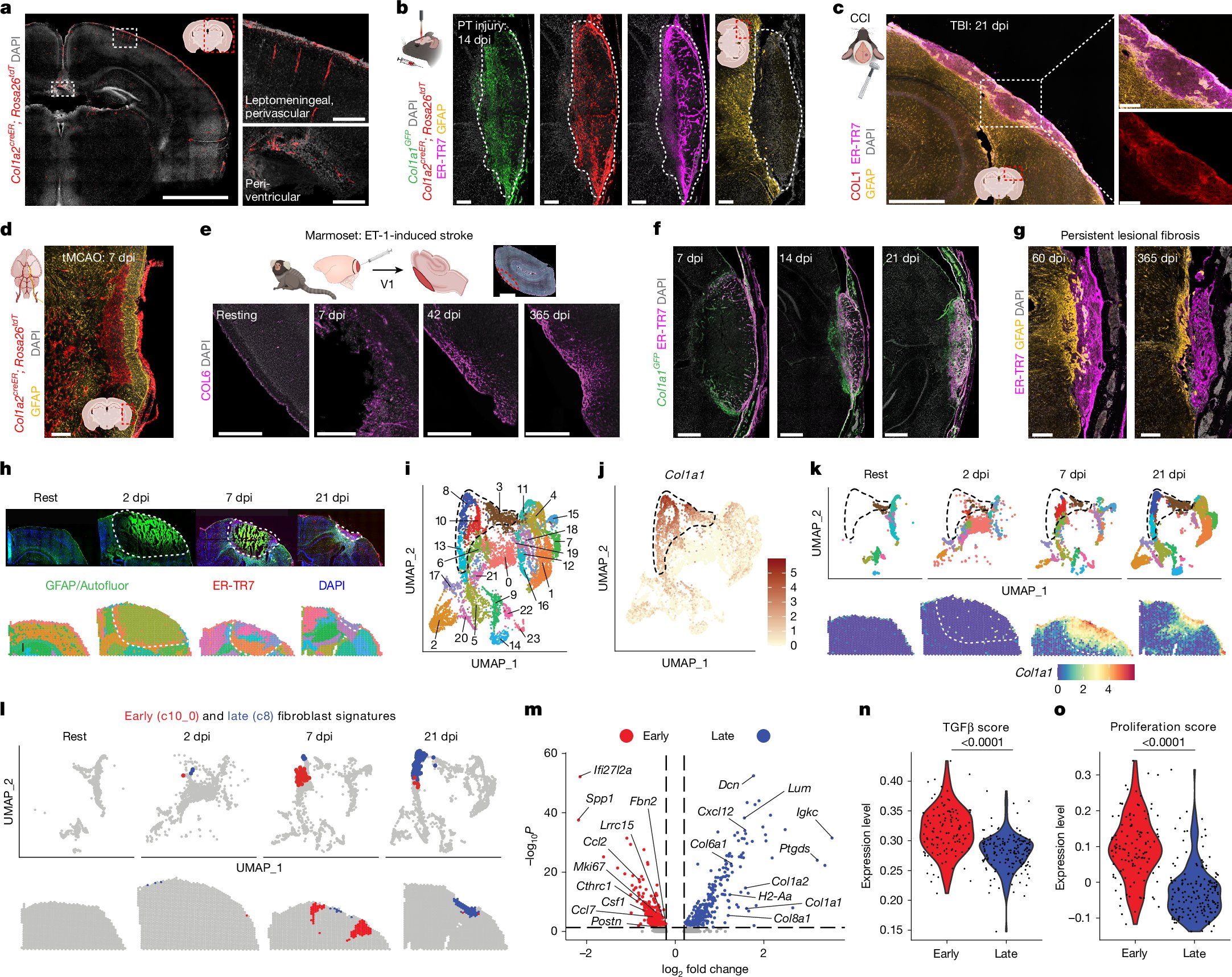 Pluchinolab's tweet card. Nature - Spatial transcriptomic studies and lineage tracing reveal that, after brain injury, transient profibrotic fibroblasts develop from existing brain fibroblasts, infiltrate lesions, regulate...