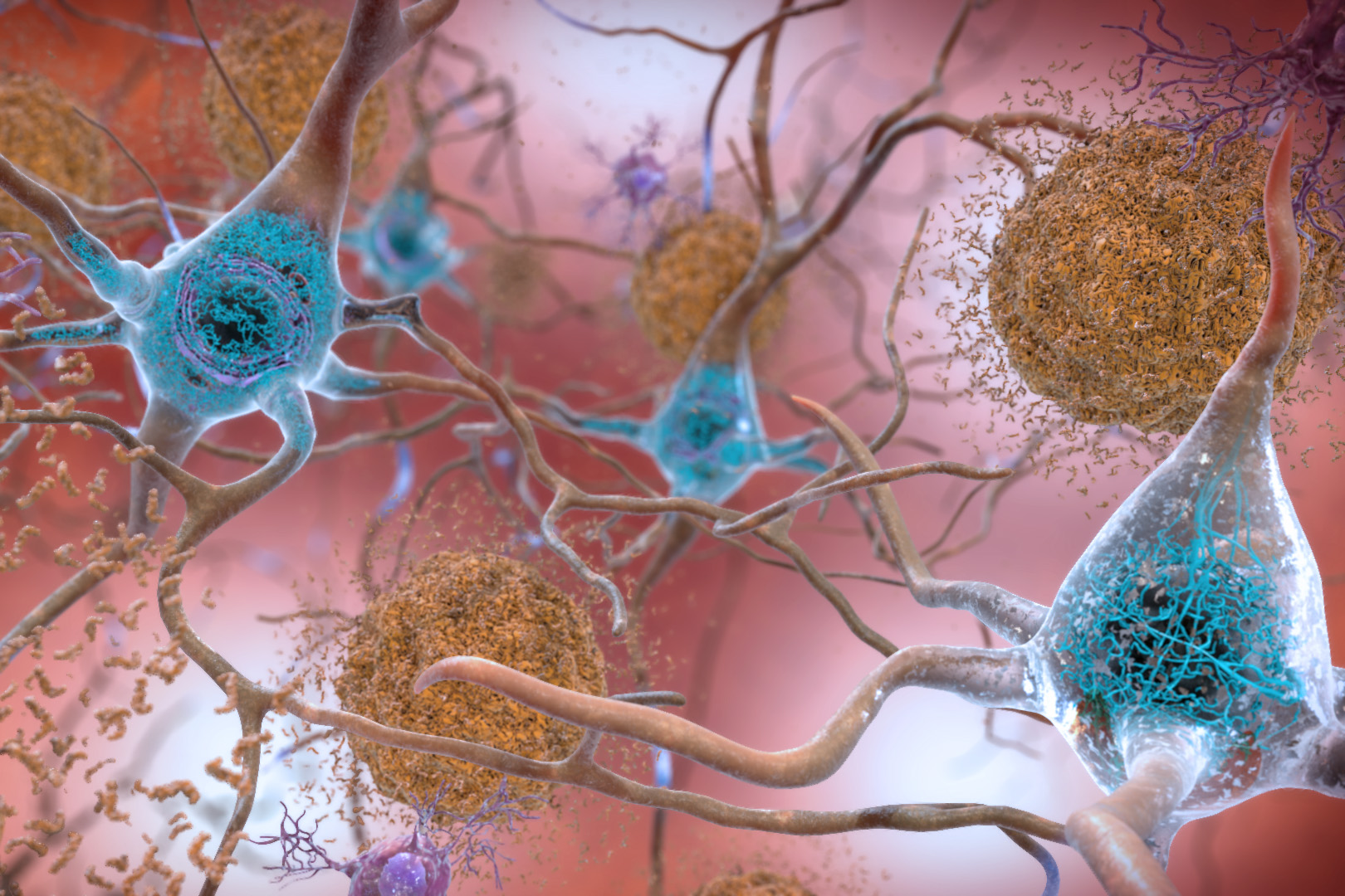 ScienceMIT's tweet card. An MIT study reveals how rare variants of a gene called ABCA7 may contribute to the development of Alzheimer’s by disrupting lipid metabolism in neurons.