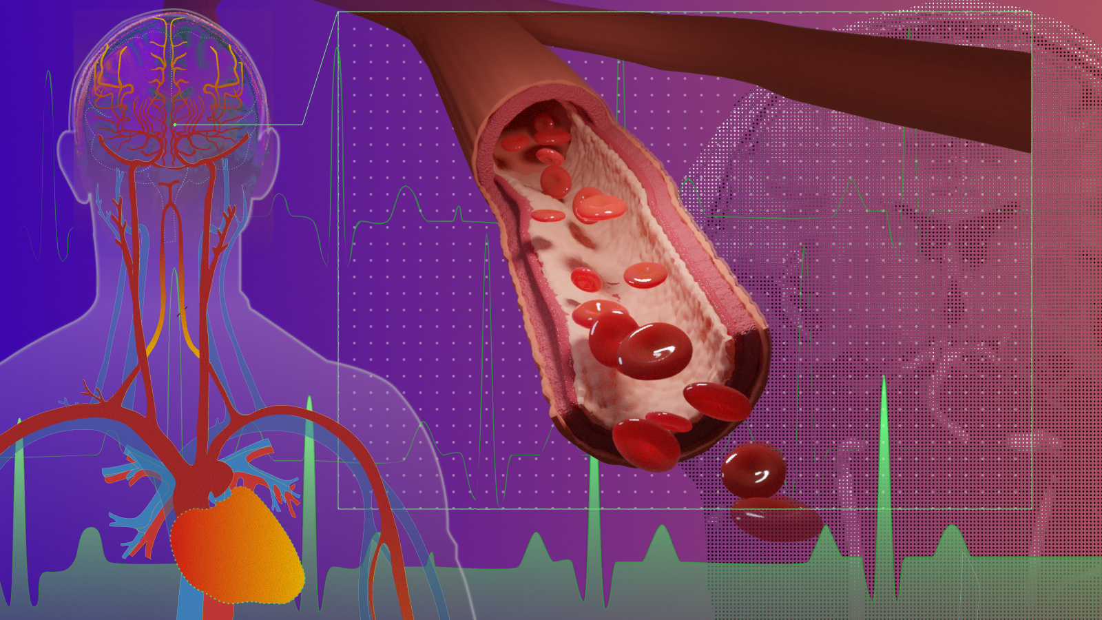 USC's tweet card. Related News USC study finds new evidence linking dementia to problems with the brain’s waste clearance system January 7, 2025 PFAS exposure linked to decreased bone health in adolescents and […]