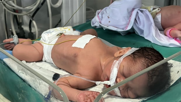 CBCNews's tweet card. After their three children were killed in an Israeli strike on their home in Gaza City last year, Diana and Omar Al-Rubai were just days away from the expected arrival of their baby when they were...