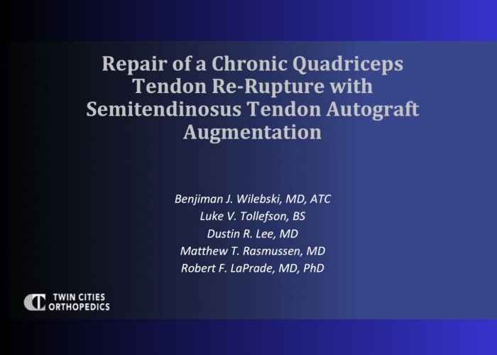 thekneedoc's tweet card. Repair of a Chronic Quadriceps Tendon Re-rupture With Semitendinosus Tendon Autograft Augmentation