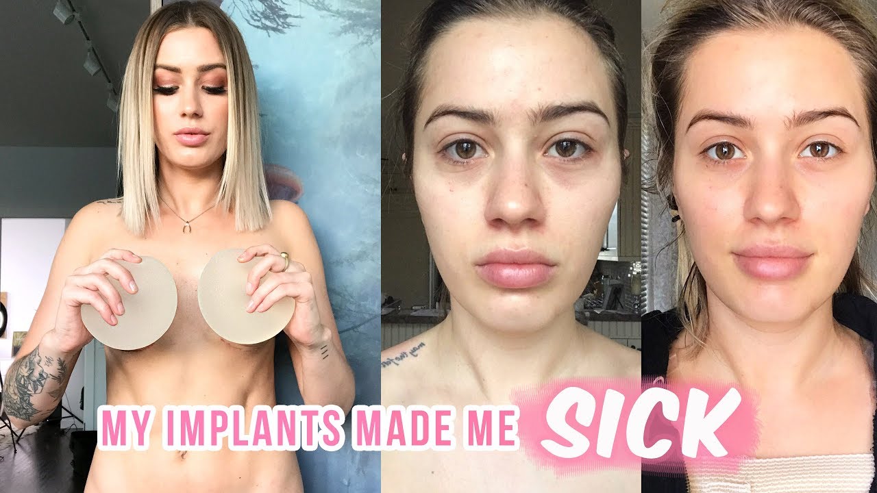 lucyparge's tweet card. The TRUTH about BREAST IMPLANTS - Breast Implant Illness (Before/...