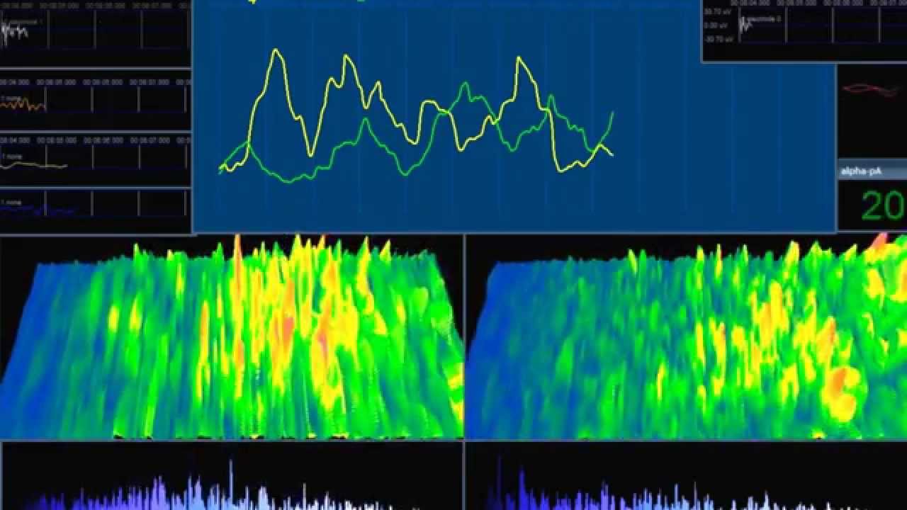 metavolution's tweet card. MeTaVoLuT1oN brainwave visuals Open-BCI Neurofeedback ArT Installat...