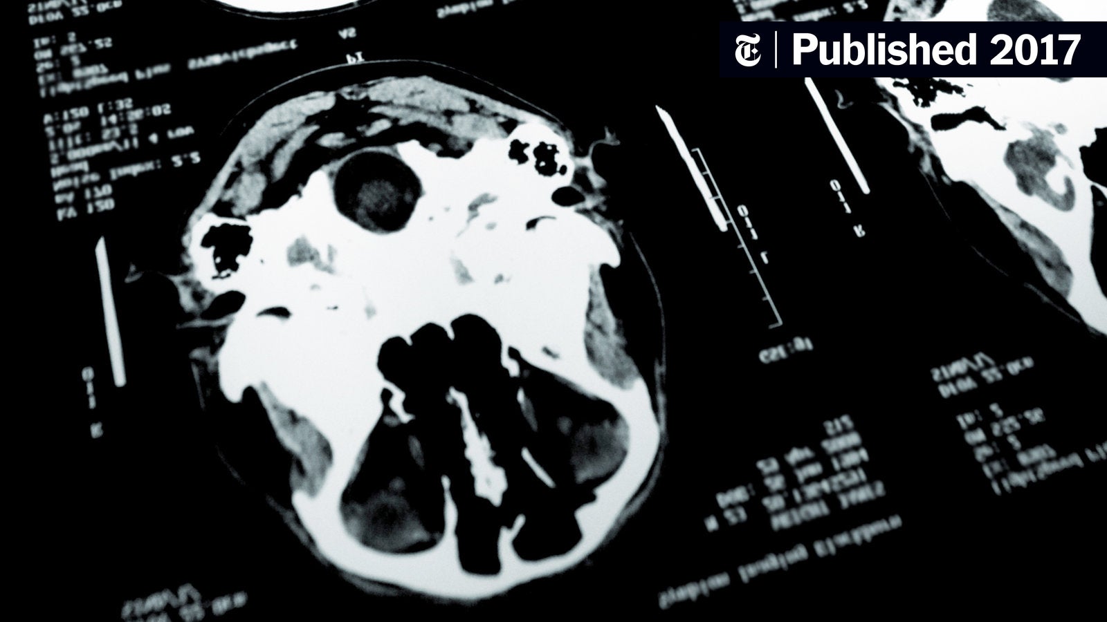 neurofreiburg's tweet card. In “The Brain Defense,” Kevin Davis considers whether new developments in neuroscience could redefine innocence and culpability.