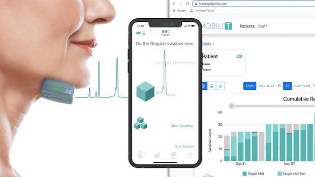 CSNPcollision's tweet card. A health tech company has developed a product for anyone struggling with swallowing, and for David Jamieson it has been transformative. 
