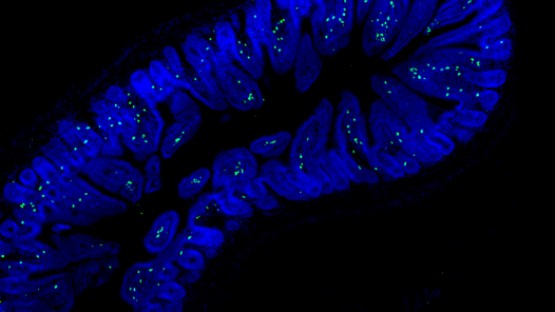 SnackSoftware's tweet card. A high-salt diet reduces resting blood flow to the brain and causes dementia in mice, according to a new Weill Cornell Medicine study.
