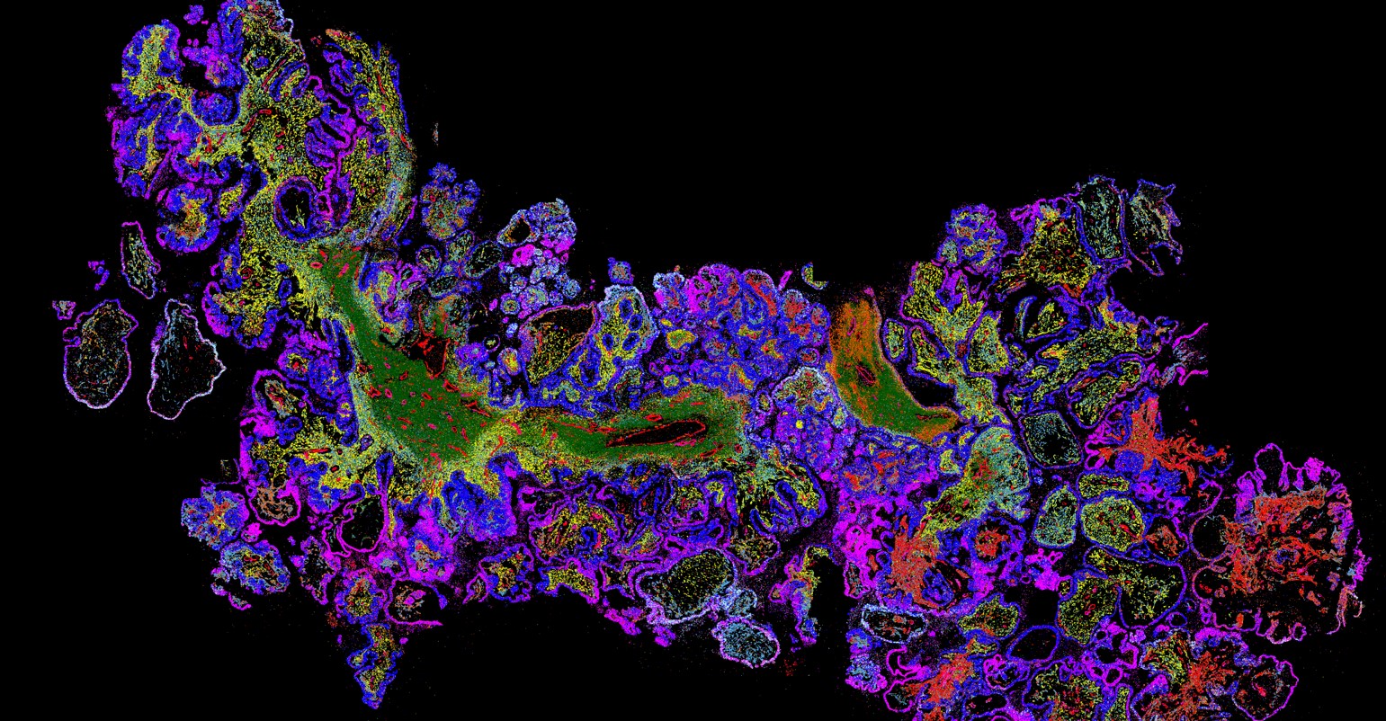 SpatialBioHub's tweet card. The combined company—which will carry the Vizgen name—will build upon its namesake predecessor’s expertise in single-cell spatial genomics and Ultivue’s leadership in multiplex proteomic profiling.