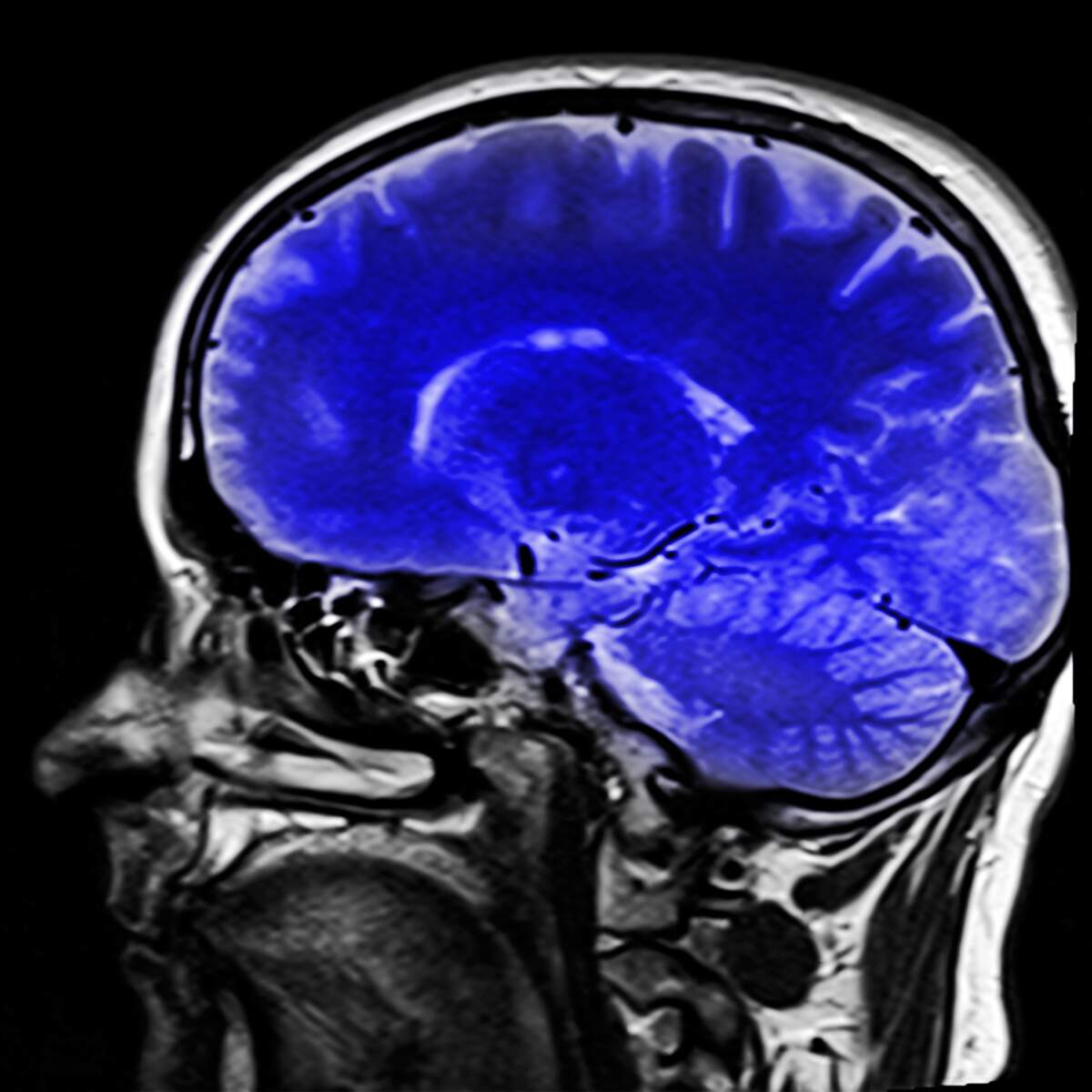 robinsnewswire's tweet card. National Train Your Brain Day is being observed today! It is observed annually on October 13th.