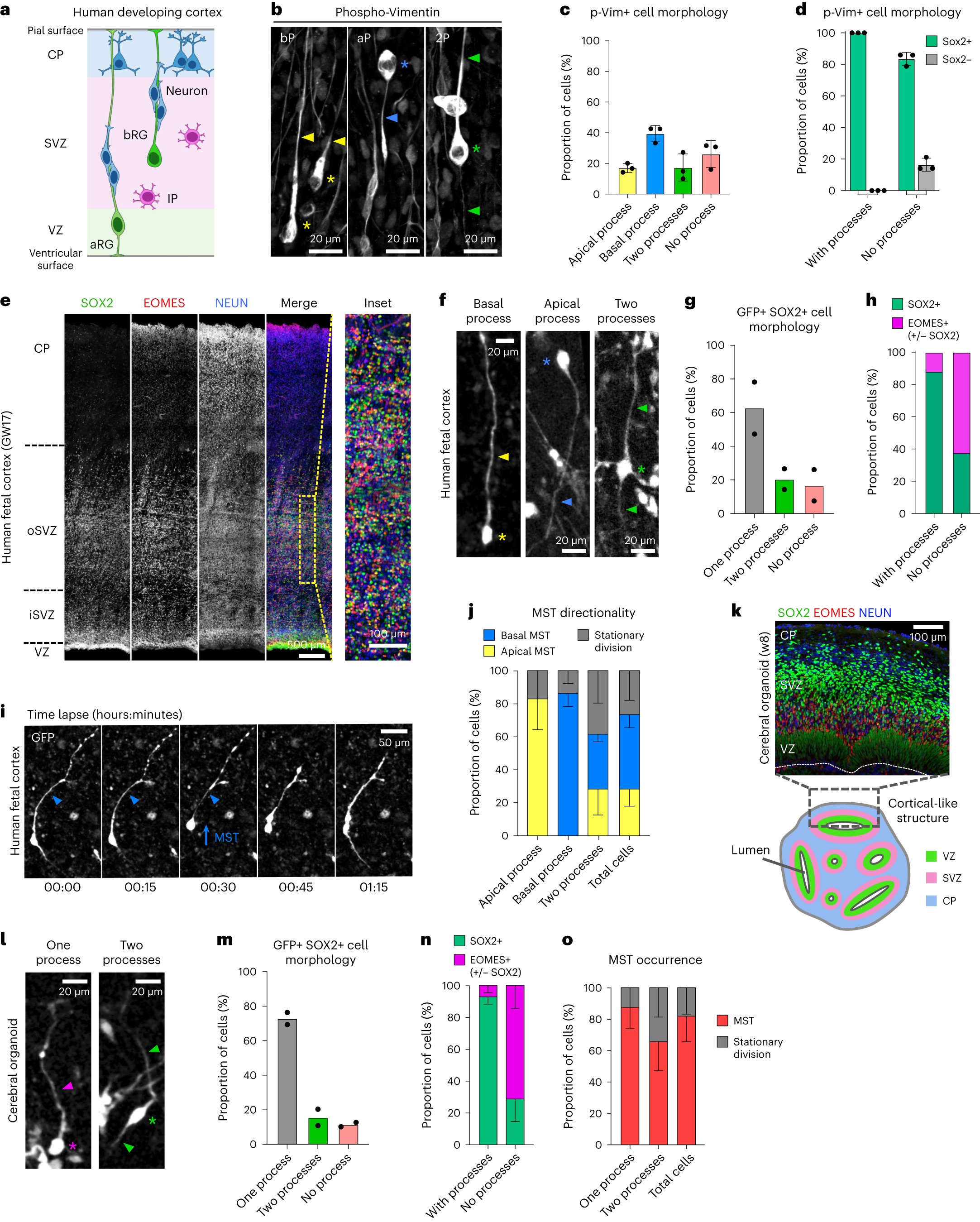 cedricboeckx's tweet card. Nature Cell Biology - Coquand, Brunet Avalos et al. develop an imaging method to map basal radial glial cell division in human fetal tissue and cerebral organoids and detect abundant symmetric...