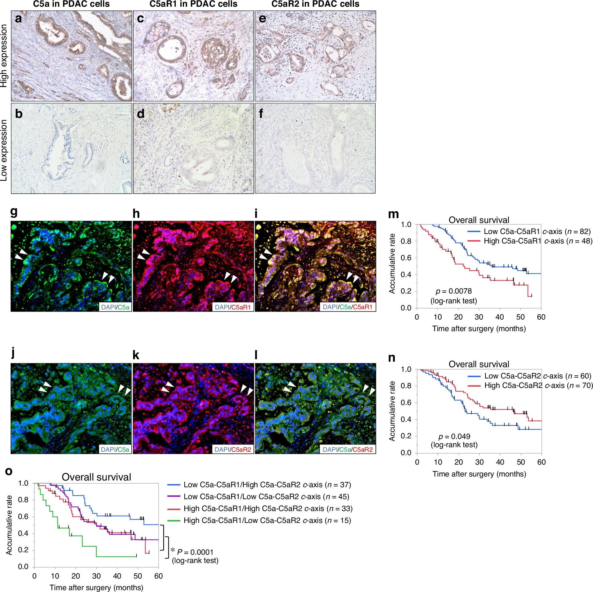 StreetCred2017's tweet card. British Journal of Cancer - Inhibition of C5a-C5aR1 axis suppresses tumour progression by enhancing antitumour immunity and chemotherapeutic effect in pancreatic ductal adenocarcinoma