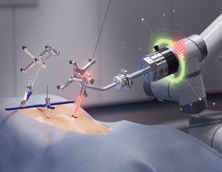 perlove_robot's tweet card. Robotic-assisted spinal navigation ensures high-precision and safety in pedicle screw placement. Learn the key technologies behind 3D imaging, real-time navigation, and intelligent control that...