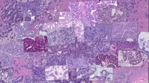 exascaleproject's tweet card. Cross-agency cooperation between Department of Energy laboratories and National Cancer Institute researchers helps take the guesswork out of cancer treatments. What happens when Department of Energy...